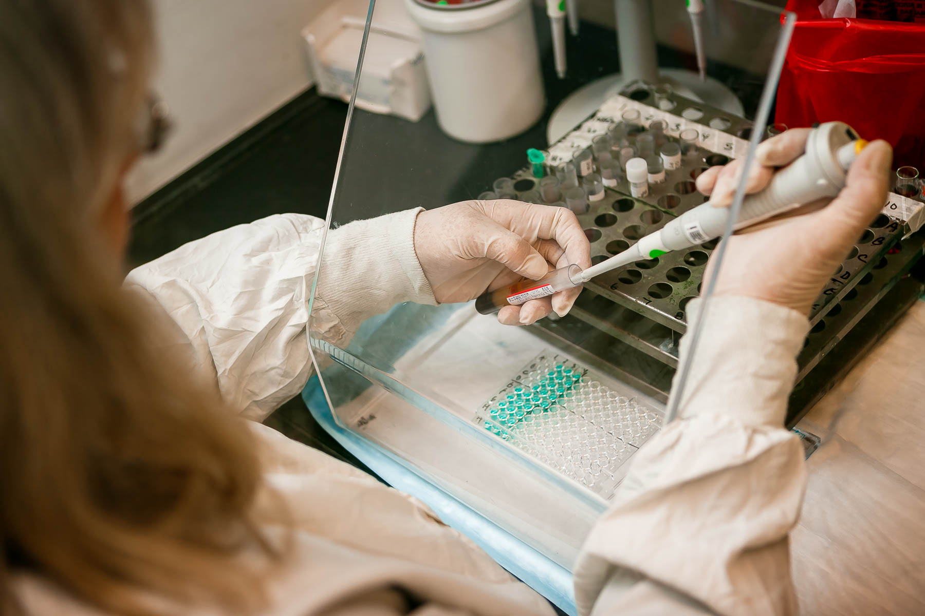 Testing being performed in the Diagnostic Immunology Laboratory