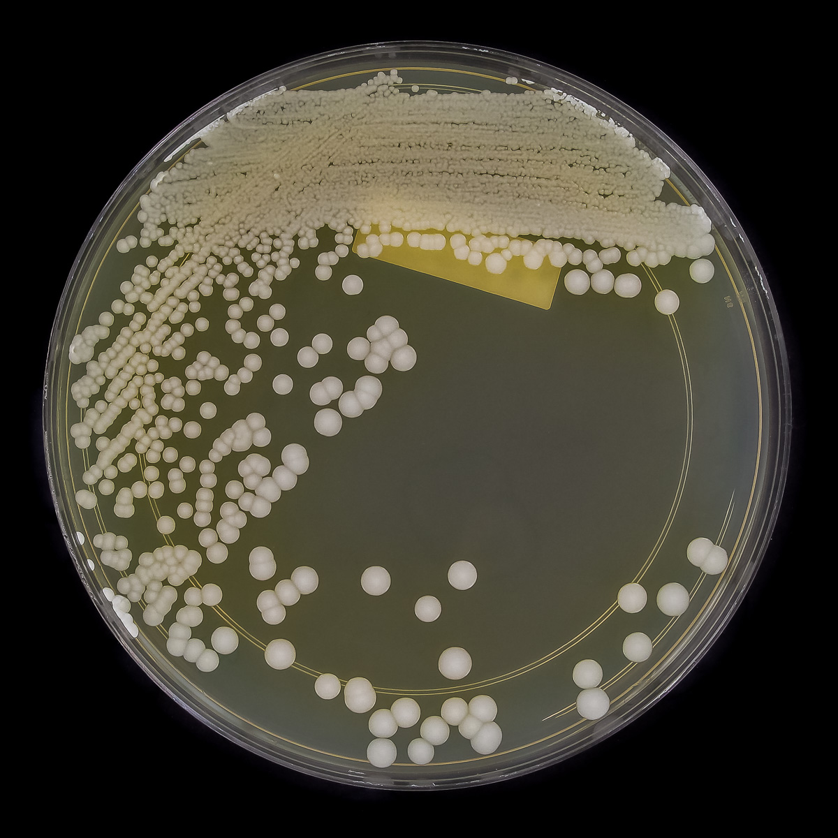 Candida auris