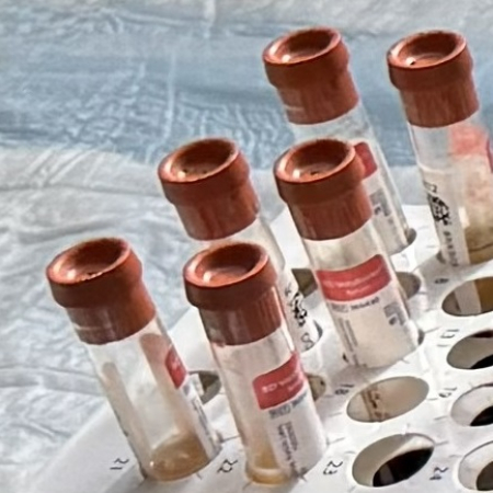 Tubes containing serum for secondhand smoke exposure study