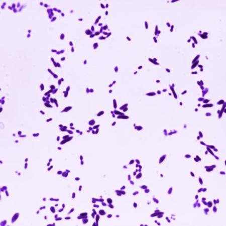 Streptococcus pneumoniae Photo credit: CDC / Arnold Kaufman
