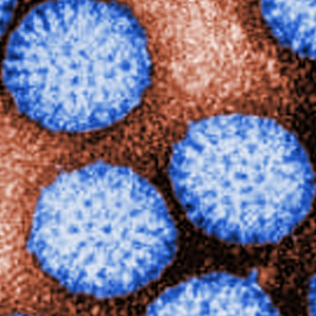 Rotavirus. Photo credit: Bryon Skinner; Content providers: CDC/Dr. Erskine Palmer