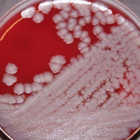 B. anthracis Sterne strain