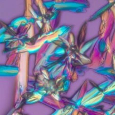 Polarized light image of glucose. Richard Cole, Wadsworth Center