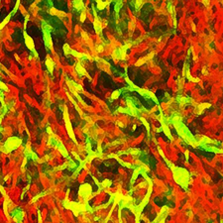 Biofilms of Mycobacterium smegmatis cells Biofilms of Mycobacterium smegmatis cells