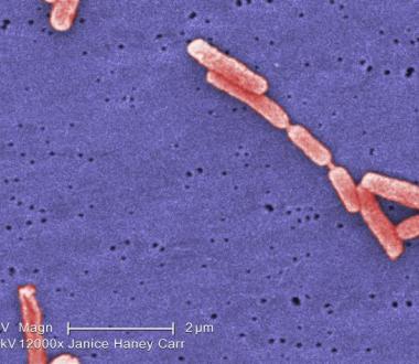 Colorized SEM Legionella. Photo credit: Janice Haney Carr; Content: CDC/Margaret Williams, Claressa Lucas, Tatiana Travis