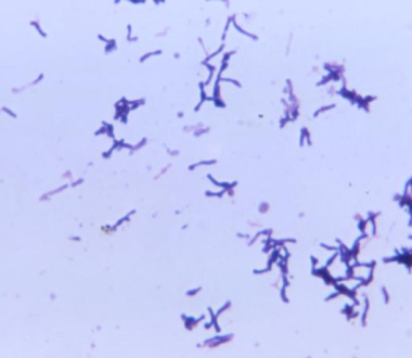 Propionibacterium acnes
