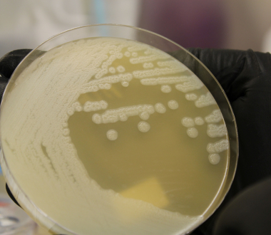 Clostridium botulinum