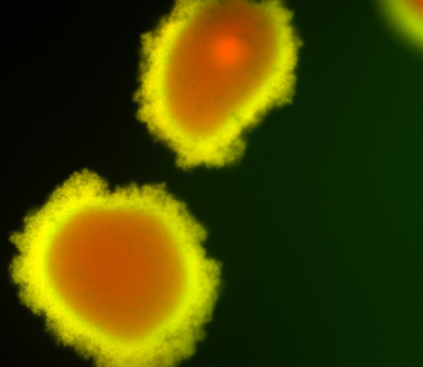 Differentiated biofilms of M. abscessus