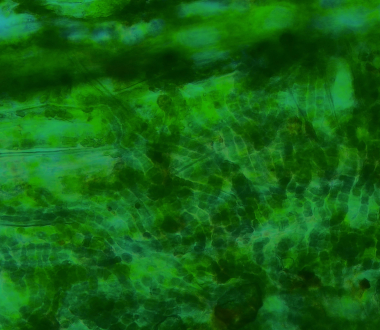 Micrograph of Aetokthonos hydrillicola-like cyanobacteria (darker filamentous colonies) on the leaf of Hydrilla verticillata. Photo Credit: Theresa Hattenrath