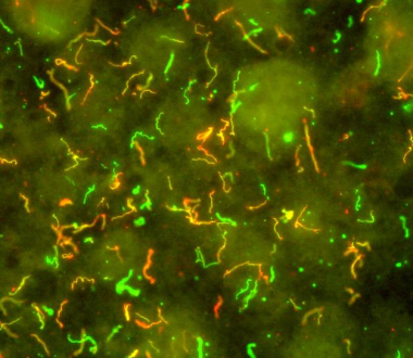 Lyme Disease Bacteria, Borrelia burgdorferi Credit: NIAID, NIH
