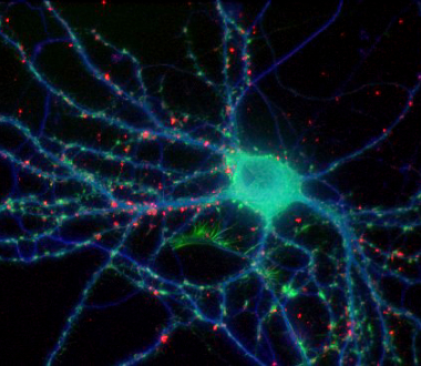 Fixed neuron. Tubulin shown in blue, F-actin in green, presynaptic protein in red. Specimen courtesy of Natalie Dowell-Mesfin