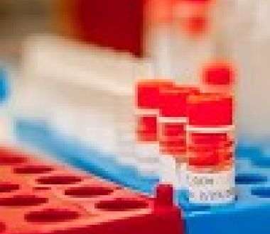 Change in Newborn Screening Program's Hemoglobinopathy Algorithm