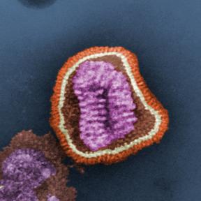 Influenza virus. Photo credit Frederick Murphy. Content provider CDC/Erskine Palmer, PhD; ML Martin