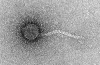 Caption: A transmission electron micrograph of phage FtMidnight, which is dependent on the F plasmid of E. coli.