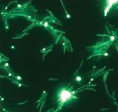 M. smegmatis ESX-1 proteins fused to the yellow fluorescent protein are seen as distinct foci localized to the cell pole.