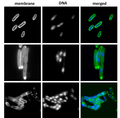 Plague bacilli exhibit a growth defect at host temperatures when the global regulatory gene hfq is deleted (middle panel), most likely due to dysregulation of one or more small regulatory RNA molecules. Addition of a good hfq gene copy restores normal growth (bottom). The top panel includes wild type Y. pestis for reference. Plague bacilli exhibit a growth defect at host temperatures when the global regulatory gene hfq is deleted (middle panel).