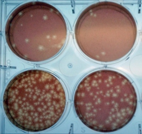 Plaque reduction neutralization test