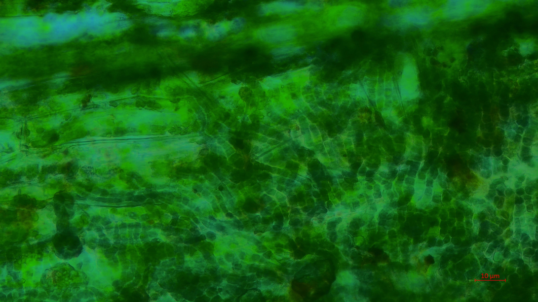 Micrograph of Aetokthonos hydrillicola-like cyanobacteria (darker filamentous colonies) on the leaf of Hydrilla verticillata. Photo Credit: Theresa Hattenrath